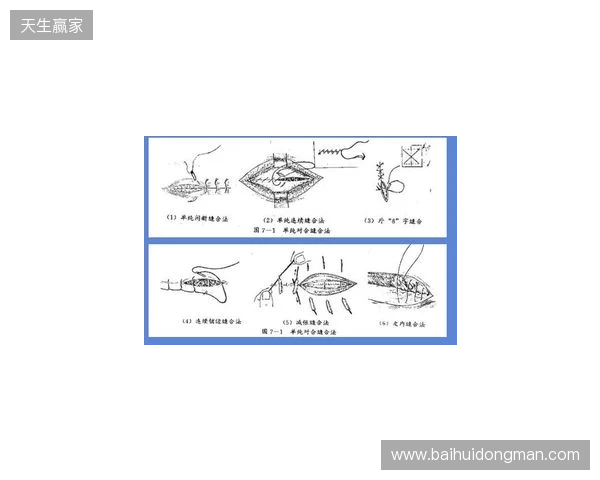 广州豹官方:杨浩眉弓伤口缝合30余针,预计5-7天后拆线 广州豹官方:杨浩眉弓伤口缝合30余针,预计5-7天后拆线